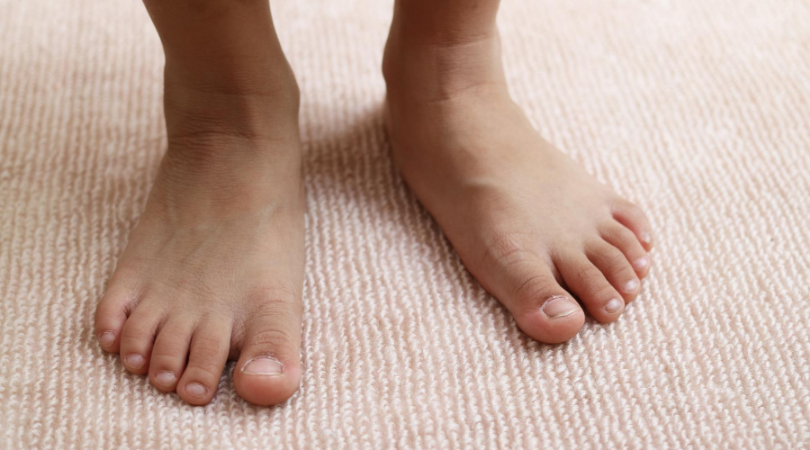flat feet plantar fasciitis in bare feet